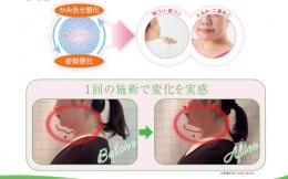 顔筋解放メソッド