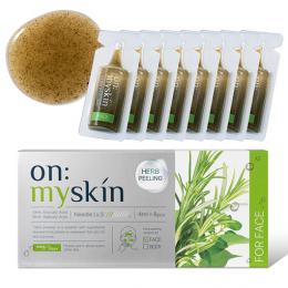 on:myskin